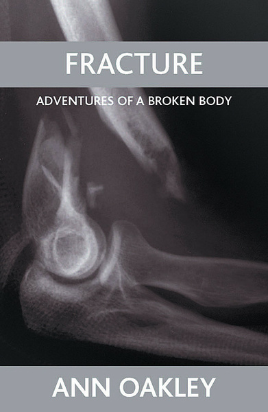 Policy Press | Fracture - Adventures of a broken body, By Ann Oakley